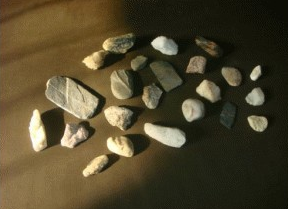 尿道結(jié)石的危害有哪些?